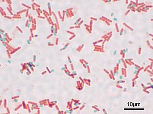 Bacillus subtilis Spore.jpg